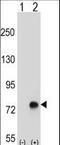 Transforming Growth Factor Beta Induced antibody, LS-C161830, Lifespan Biosciences, Western Blot image 