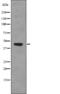 Pyruvate Dehydrogenase E1 Alpha 1 Subunit antibody, abx217691, Abbexa, Western Blot image 