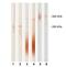 Pappalysin 1 antibody, GTX14597, GeneTex, Western Blot image 