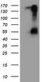 Serine Peptidase Inhibitor, Kunitz Type 1 antibody, TA504591, Origene, Western Blot image 