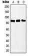 Polyribonucleotide Nucleotidyltransferase 1 antibody, LS-C354215, Lifespan Biosciences, Western Blot image 