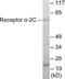 Adrenoceptor Alpha 2C antibody, EKC1686, Boster Biological Technology, Western Blot image 