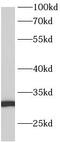 Ankyrin Repeat Domain 7 antibody, FNab00421, FineTest, Western Blot image 