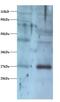 NADH:Ubiquinone Oxidoreductase Core Subunit V2 antibody, LS-C212134, Lifespan Biosciences, Western Blot image 