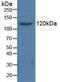 Histone Deacetylase 6 antibody, LS-C298035, Lifespan Biosciences, Western Blot image 