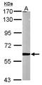 Matrix Metallopeptidase 2 antibody, LS-C185627, Lifespan Biosciences, Western Blot image 