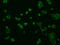 MTOR Associated Protein, Eak-7 Homolog antibody, GTX84265, GeneTex, Immunofluorescence image 