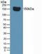 Complement Factor H antibody, LS-C721970, Lifespan Biosciences, Western Blot image 