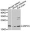 Actin Related Protein 2/3 Complex Subunit 5 antibody, A8571, ABclonal Technology, Western Blot image 