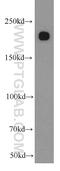 Myosin Heavy Chain 9 antibody, 11128-1-AP, Proteintech Group, Western Blot image 