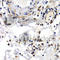 Pyruvate Kinase L/R antibody, A1924, ABclonal Technology, Immunohistochemistry paraffin image 
