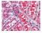 Suppressor Of Cytokine Signaling 1 antibody, ab9870, Abcam, Immunohistochemistry paraffin image 