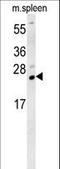 Transmembrane And Ubiquitin Like Domain Containing 1 antibody, LS-C162049, Lifespan Biosciences, Western Blot image 