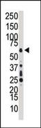 Mitogen-Activated Protein Kinase Kinase Kinase 7 antibody, PA5-15149, Invitrogen Antibodies, Western Blot image 