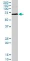 MAPK Activated Protein Kinase 2 antibody, H00009261-M08, Novus Biologicals, Western Blot image 