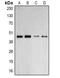 Actin-related protein 2 antibody, LS-C482490, Lifespan Biosciences, Western Blot image 