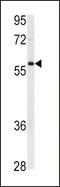 X-Linked Inhibitor Of Apoptosis antibody, MBS9214031, MyBioSource, Western Blot image 