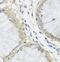 Metaxin 1 antibody, FNab05424, FineTest, Immunohistochemistry frozen image 