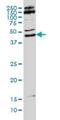 Makorin Ring Finger Protein 2 antibody, H00023609-M01, Novus Biologicals, Western Blot image 