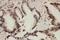 Cullin 1 antibody, PA1557, Boster Biological Technology, Immunohistochemistry paraffin image 