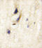 Disheveled-associated activator of morphogenesis 1 antibody, abx031656, Abbexa, Immunohistochemistry paraffin image 