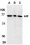 Thioredoxin Domain Containing 12 antibody, SP1293P, Origene, Western Blot image 