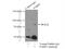 Poly(ADP-Ribose) Polymerase Family Member 9 antibody, 17535-1-AP, Proteintech Group, Immunoprecipitation image 