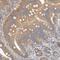 Huntingtin antibody, NBP1-89710, Novus Biologicals, Immunohistochemistry frozen image 