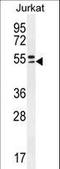 Tripartite Motif Containing 59 antibody, LS-C160205, Lifespan Biosciences, Western Blot image 