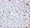 Prx-III antibody, PA1836, Boster Biological Technology, Immunohistochemistry paraffin image 