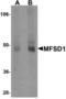 Major Facilitator Superfamily Domain Containing 1 antibody, LS-B5347, Lifespan Biosciences, Western Blot image 