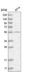 G Protein-Coupled Receptor Kinase 4 antibody, NBP2-55415, Novus Biologicals, Western Blot image 