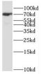 G Protein Nucleolar 1 (Putative) antibody, FNab03548, FineTest, Western Blot image 