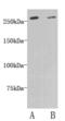 DOP1 Leucine Zipper Like Protein B antibody, MBS856784, MyBioSource, Western Blot image 