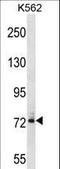 Dynein Axonemal Intermediate Chain 1 antibody, LS-C167459, Lifespan Biosciences, Western Blot image 