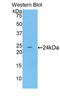 Troponin I1, Slow Skeletal Type antibody, LS-C299287, Lifespan Biosciences, Western Blot image 