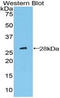 Patched 1 antibody, MBS2003346, MyBioSource, Western Blot image 