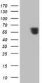 Retinoic acid receptor alpha antibody, CF806351, Origene, Western Blot image 