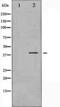 Mitogen-Activated Protein Kinase Kinase 3 antibody, TA325641, Origene, Western Blot image 