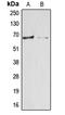 Arylsulfatase E antibody, LS-C351842, Lifespan Biosciences, Western Blot image 