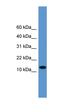 Tachykinin Precursor 1 antibody, orb333728, Biorbyt, Western Blot image 