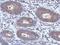Poly(ADP-Ribose) Polymerase Family Member 11 antibody, PA5-28545, Invitrogen Antibodies, Immunohistochemistry paraffin image 