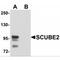 Signal Peptide, CUB Domain And EGF Like Domain Containing 2 antibody, MBS150534, MyBioSource, Western Blot image 