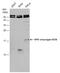 Human Papilloma virus antibody, GTX132687, GeneTex, Western Blot image 