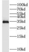 Testis Expressed 264, ER-Phagy Receptor antibody, FNab08611, FineTest, Western Blot image 