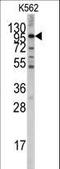 Leucine Rich Repeat Containing G Protein-Coupled Receptor 5 antibody, LS-C98620, Lifespan Biosciences, Western Blot image 