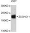 Terminal Uridylyl Transferase 4 antibody, A5972, ABclonal Technology, Western Blot image 