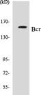 BCR Activator Of RhoGEF And GTPase antibody, EKC1058, Boster Biological Technology, Western Blot image 