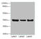 Zinc Finger Protein 625 antibody, A61978-100, Epigentek, Western Blot image 