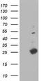 Deoxythymidylate Kinase antibody, TA503497, Origene, Western Blot image 